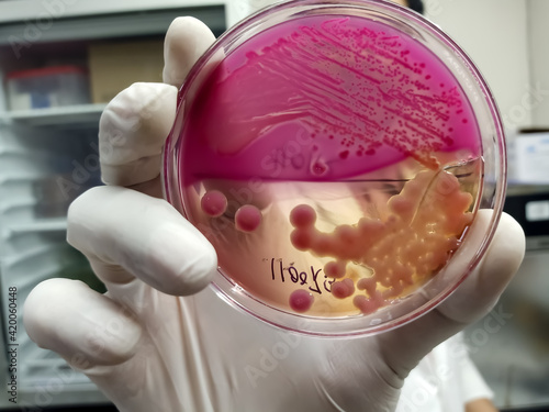 Scientist or Lab technologist hold culture media plate which is ready for bacterial culture in microbiology showing the growth of Escherichia coli. Petri dish, MacConkey Agar media. photo