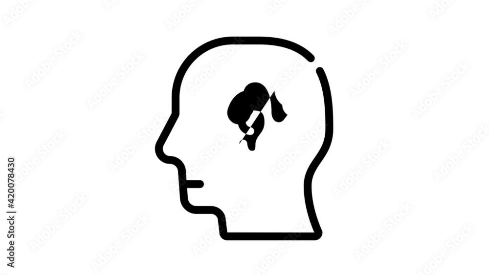 cochlear implant black icon animation cochlear implant black icon animation