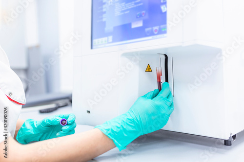 Lab technician holding blood in EDTA tube for test complete Blood Count (cbc) testing hematology laboratory. Scientific medical test with automated hematology analysis.