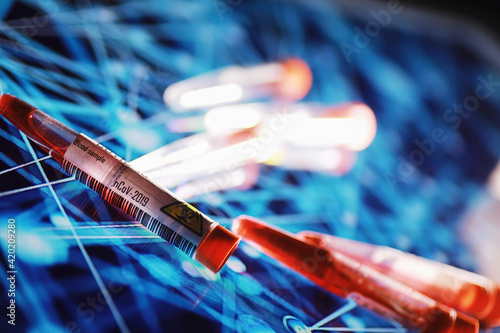 Test tube with patient blood for testing. Analysis for the virus. Coronavirus pandemic laboratory studies. Vaccine development.