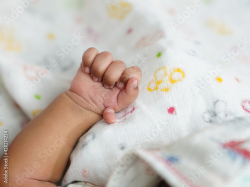 Six Fingers on Hand of New Born Baby - Preaxial Polydactyly