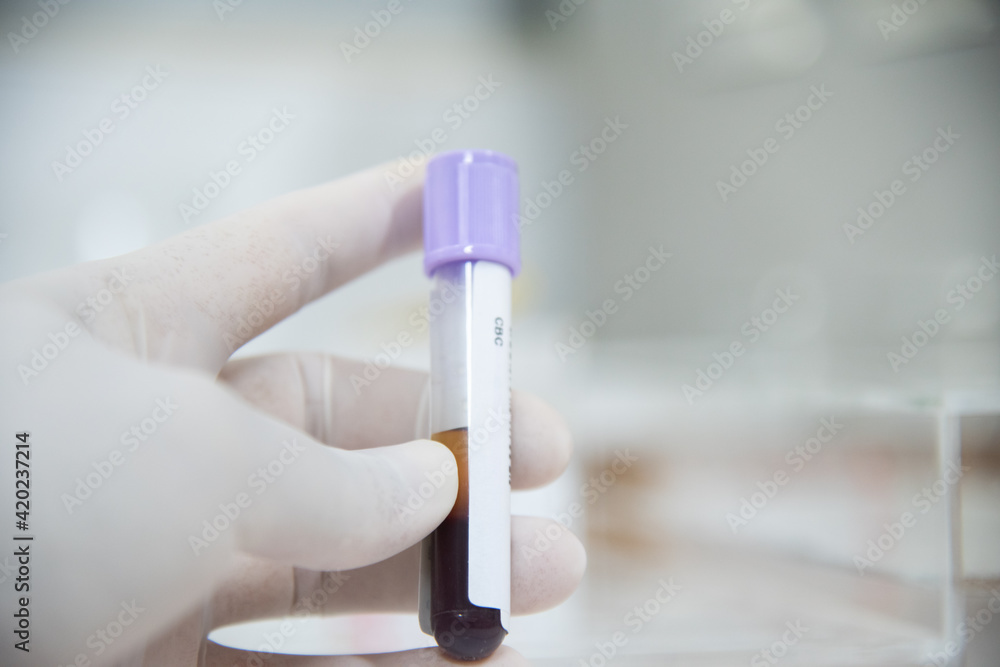 Test tube in laboratory testing. Test tube in laboratory testing.