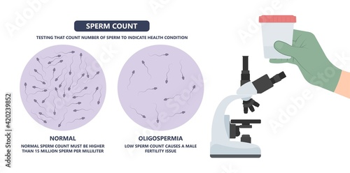 in vitro fertilization IVF semen test sample sperm count type Male biopsy fertility collect Low Poor Zero head anatomy midpiece tail birth control blocked defect abnormal ejaculate vas Non dry