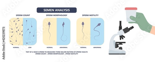 in vitro fertilization IVF semen test sample sperm count type Male biopsy fertility collect Low Poor Zero head anatomy midpiece tail birth control blocked defect abnormal ejaculate vas Non dry