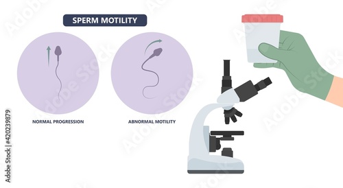 in vitro fertilization IVF semen test sample sperm count type Male biopsy fertility collect Low Poor Zero head anatomy midpiece tail birth control blocked defect abnormal ejaculate vas Non dry