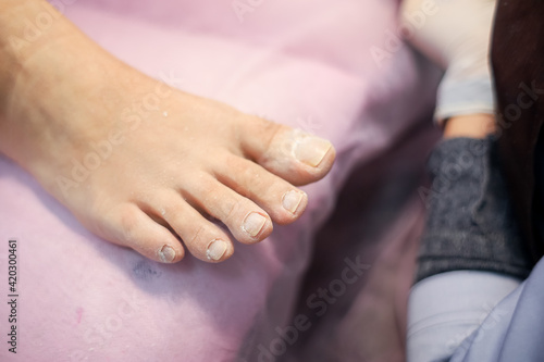 girl's foot is being treated by a pedicure master. Prepared toenails with clipped cuticle