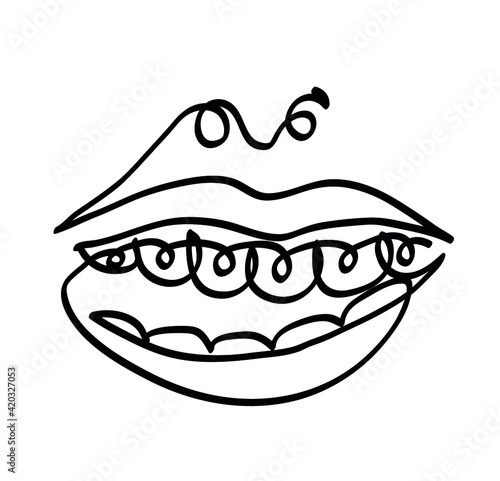 One line drawing of woman's smile with metal braces on her teeth. 
One continuous line drawing of correction of bite concept.