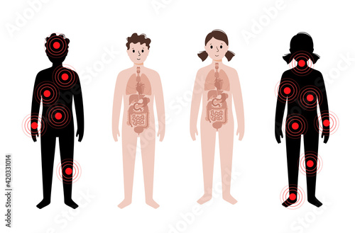 Pain in human body