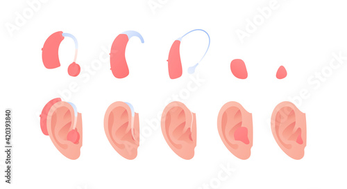 Deaf and hear aid concept. Vector flat illustration set. Collection of hearing aid device inserted into human ear isolated on white. Design element for medicine, health care.