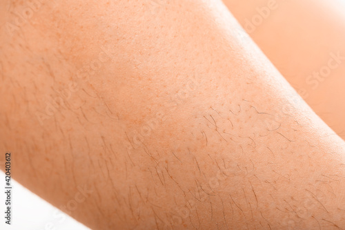 Epilated area of the skin on the background of long hair. Removal of unwanted hair Close-up