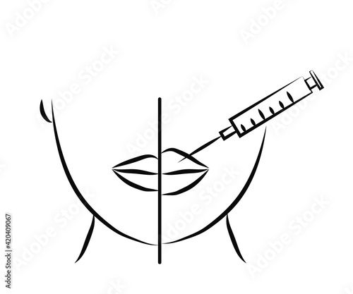 Lip augmentation with Botox. Beautiful lips and injection. Symbol. Vector illustration.