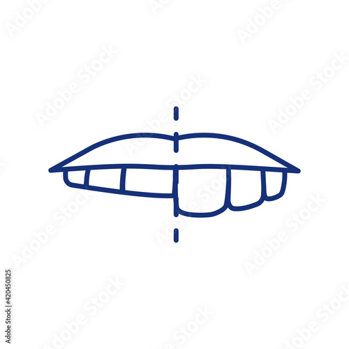 Chipped tooth RGB color icon. Bruxism. Dental conditions. Grinding teeth while sleep. Cracking, broken chewing surfaces. Dental onlay. Mouth infection. Protective enamel. Isolated vector illustration
