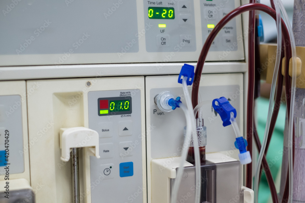 Dialysis machine is working. Acting as a substitute for the kidneys to drive waste from the body. Dialysis machine is working. Acting as a substitute for the kidneys to drive waste from the body.