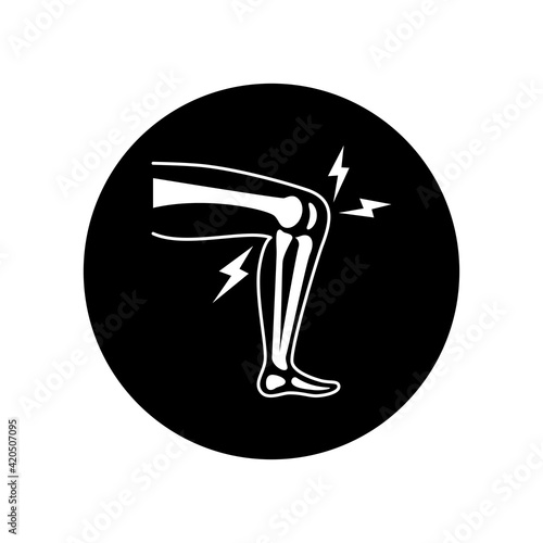 Knee arthritis black glyph icon. Inflammation joint. Sign for web page, mobile app, button, logo