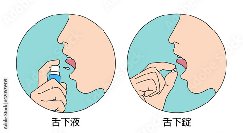 舌下免疫療法 服用 イラスト photo