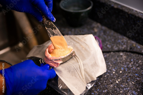 Custom Oral Mouth Mold being made with Plaster photo