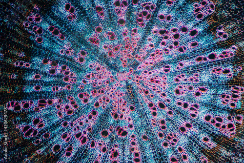 Micrograph of Sophora flavescens root