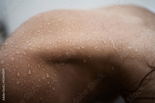 Raindrops on skin photo