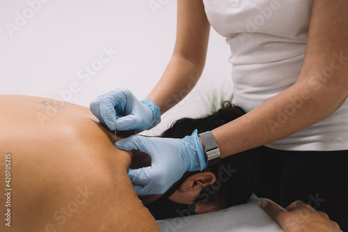 Hands hold needle puncturing a woman back