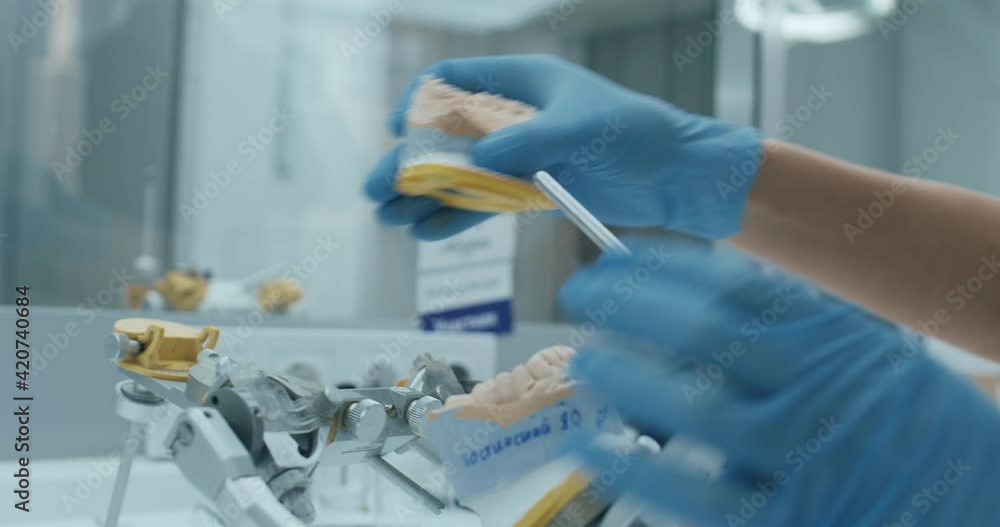 A technician is taking an upper teeth dental impression with a written surname on it out an articulator and smearing it with special mass using a metal tool. A technician is taking an upper teeth dental impression with a written surname on it out an articulator and smearing it with special mass using a metal tool.