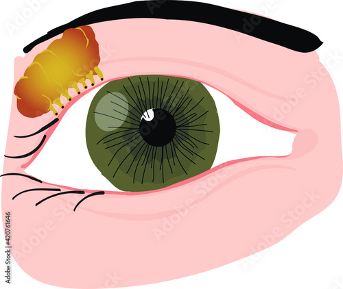 Vector Illustration of an Eye Anatomy, Lacrimotomy, Tear Gland, Lacrimal Gland