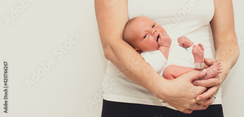 Wallpaper Mural Neonatal jaundice - yellowish discoloration of the white part of the eyes and skin in newborn baby. Mother hold baby in hands. Torontodigital.ca