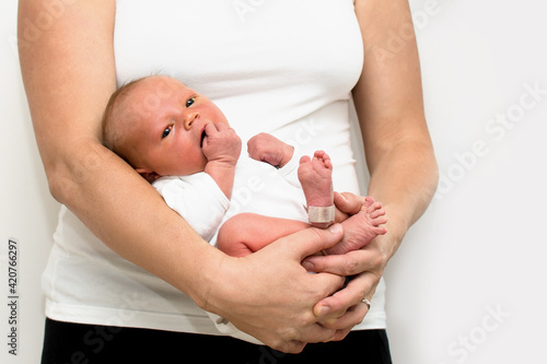 Neonatal jaundice - yellowish discoloration of the white part of the eyes and skin in newborn baby. Mother hold baby in hands. photo