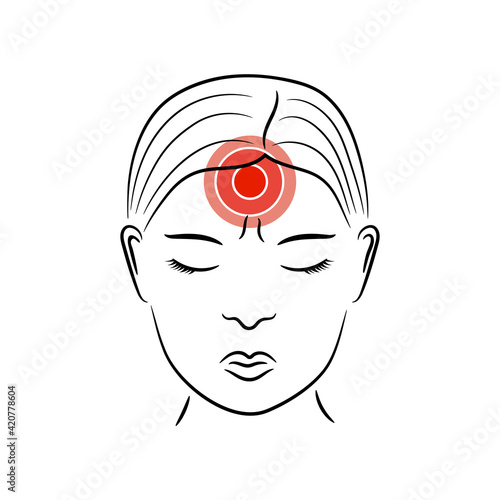 Headache vector illustration. Woman suffers from migraine pain.