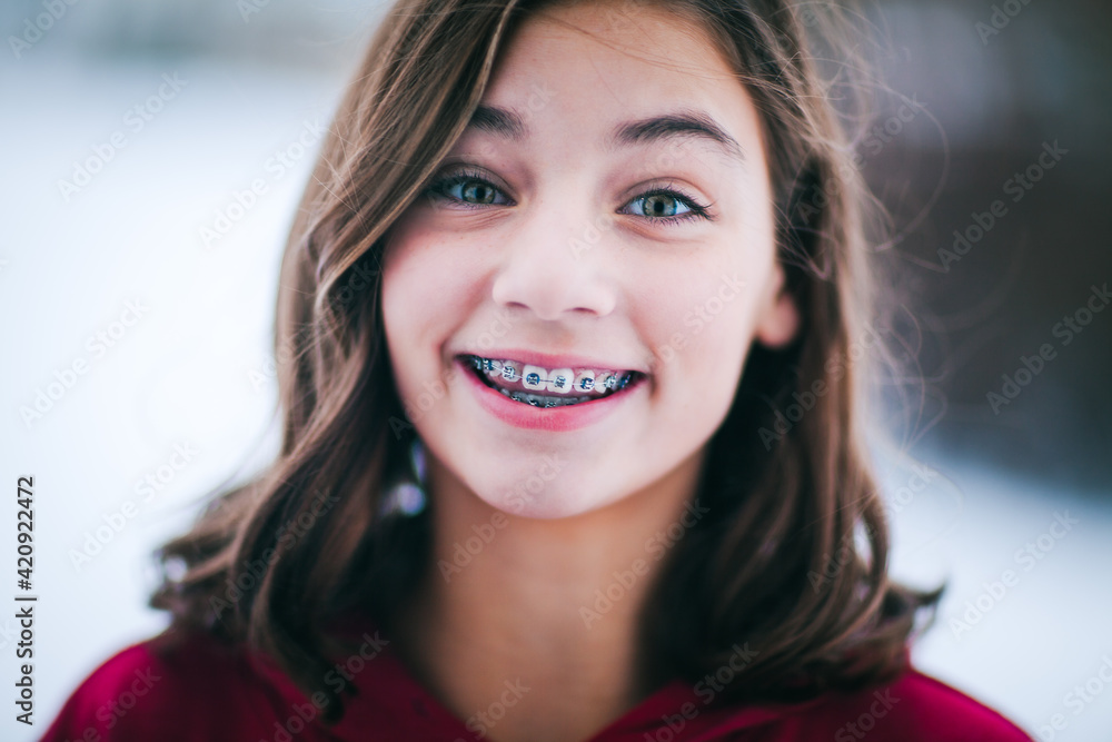Young girl with dental braces Young girl with dental braces