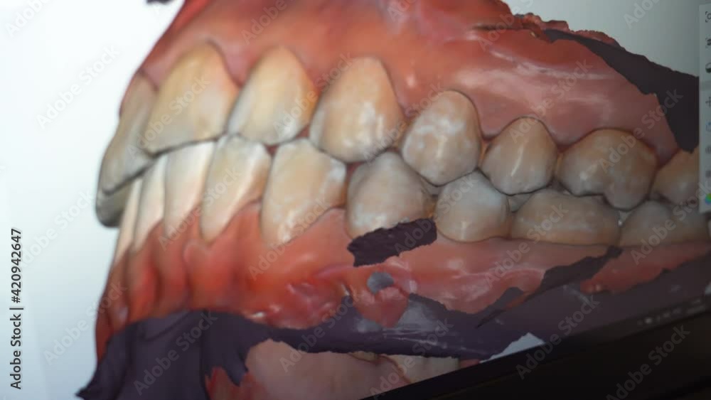 Dental consultation, diagnostics. Jaw scanning, digital imprint, medical digital technology. Dental consultation, diagnostics. Jaw scanning, digital imprint, medical digital technology.