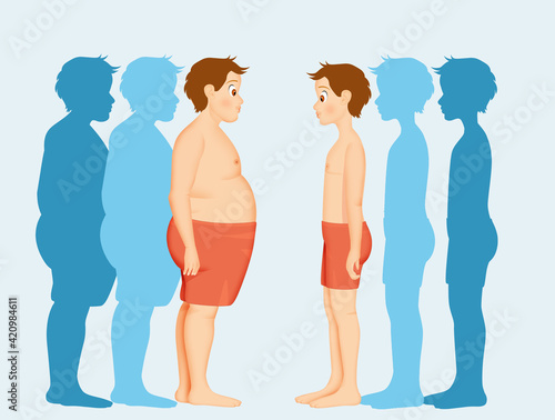 illustration of little boy with obesity problems