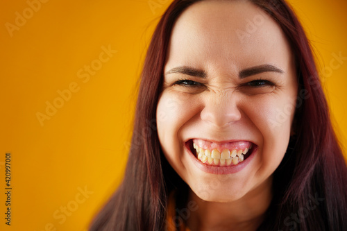 Portrait of young woman with grimacing face. Close up of funny female showing overbite on yellow background. photo