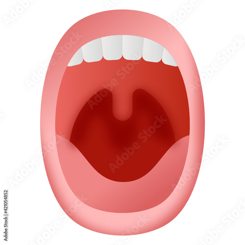 
Icon of tooth, flat design of gingivitis vector 

