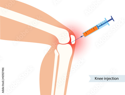 Knee Injection concept