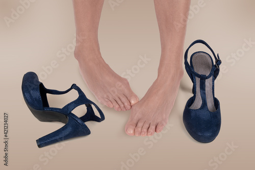  Tired female legs. Foot against high-heeled shoe. Valgus on female feet