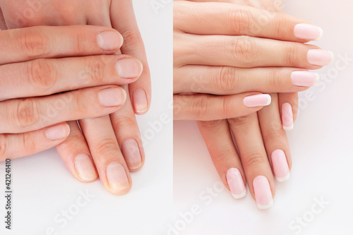 Before and after nail extension. Natural french manicure. Long nails extension  female hands