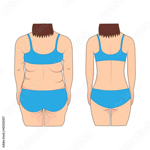 Woman's back before and after weight loss. Vector illustration.