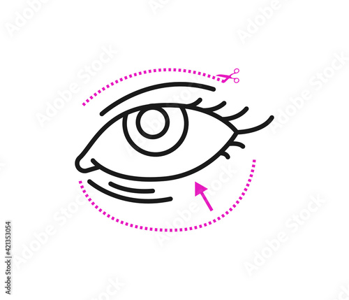 Upper eyelid reduction, eyelid lift plastic surgery concept. Wrinkles around the eyes, Face, surgery scars, anti aging treatment. Editable vector icon on white background.