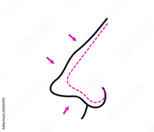 vector illustration of rhinoplasty. cosmetic surgery. aesthetic medicine. vector