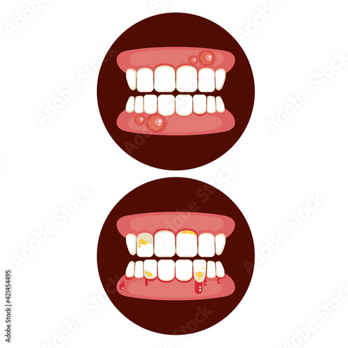 swollen gum icon