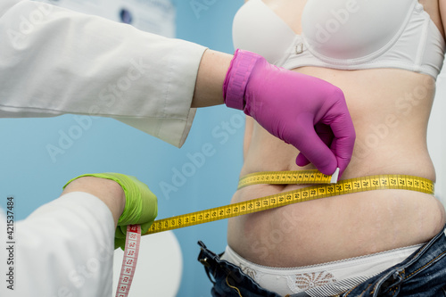 Nutritionist inspecting a woman's waist using a measuring tape to prescribe a weight loss diet. Obesity, unhealthy weight