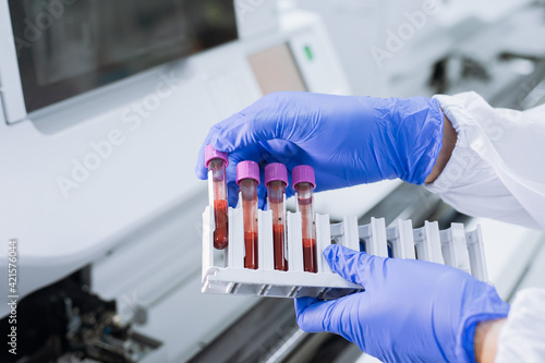 Scientist wear glove holding test tube in sample rack to check qulity of sample.