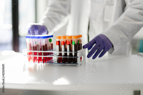 Healthcare professional with blood test tube samples in rack photo