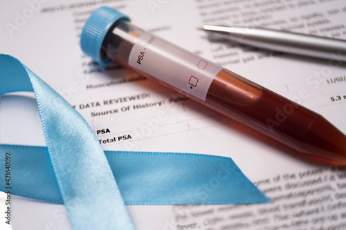 Close-up of prostate cancer blue ribbon and blood sample photo