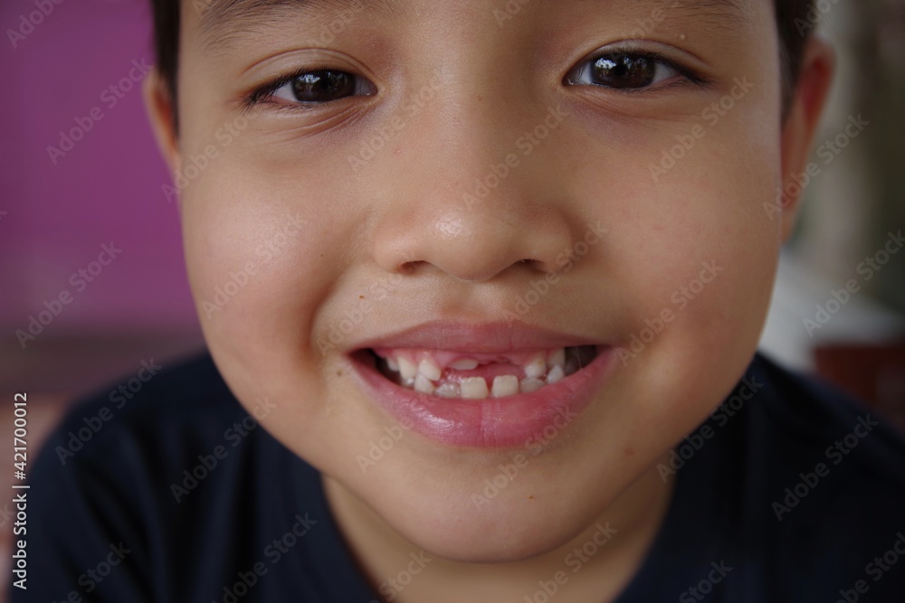 Child big smile Child big smile