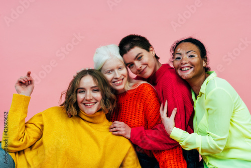 group of multiethnic women with different kind of skin posing together in studio. Concept about body positivity and self acceptance photo