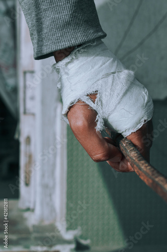 Wounded hand of a person