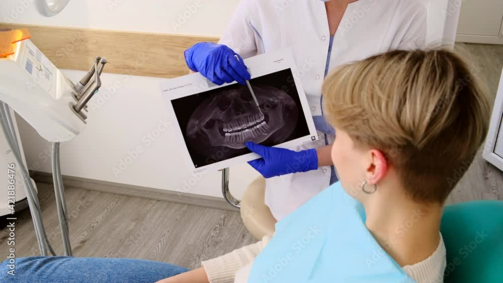 Doctor dentist shows problem areas on the x-ray for patient in stomatology office. Doctor dentist shows problem areas on the x-ray for patient in stomatology office.