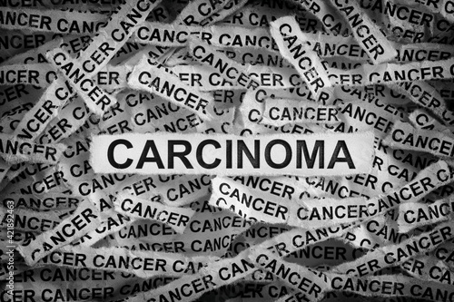Carcinoma. Torn pieces of paper with the words Carcinoma and cancer. Black and white. Close up.