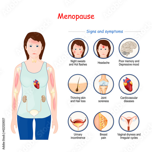 Menopause. climacteric Signs and symptoms.